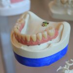Osteoporoza și impactul asupra sănătății orale